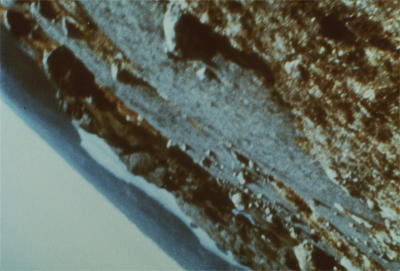 CR01